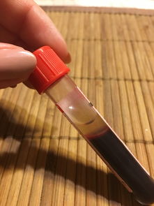 铲子皮肤品牌大解析，哪个品牌的皮肤最好？